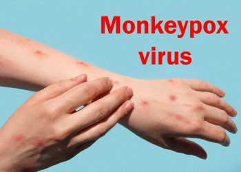 Cacar Monyet, Kenali dan Cegah Bersama Bahayanya
