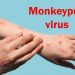 Cacar Monyet, Kenali dan Cegah Bersama Bahayanya