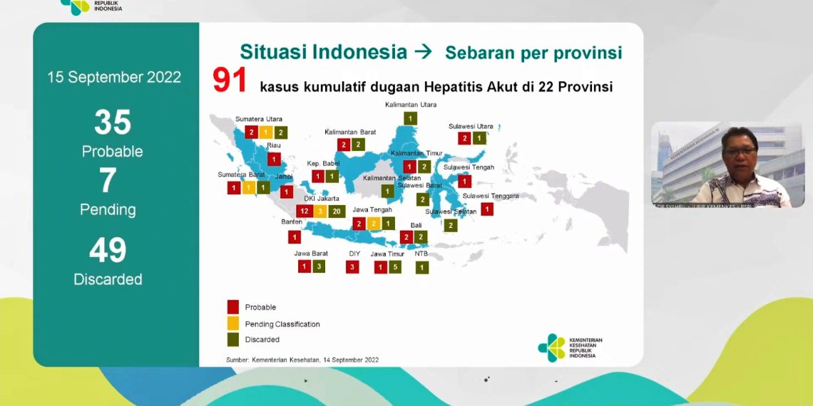 Kemenkes RI Temukan 91 Kasus Hepatitis Akut Misterius