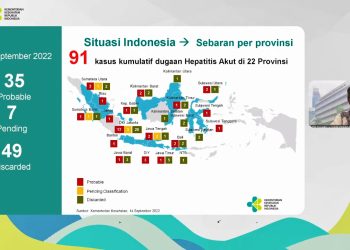 Kemenkes RI Temukan 91 Kasus Hepatitis Akut Misterius