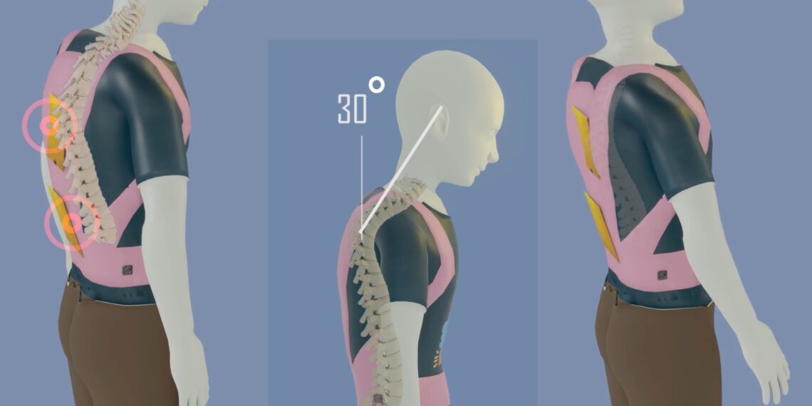 PostureCare: Inovasi UB Atasi Kelainan Tulang Belakang