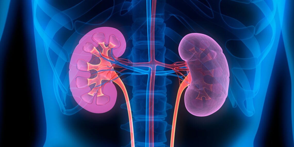 Gagal Ginjal, Ini Penyebab, Gejala dan Cara Mencegah