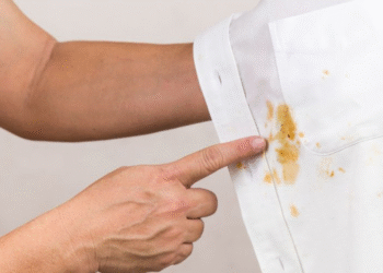 Lima Trik Ampuh Hilangkan Noda di Baju Putih