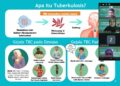 Mahasiswa UB Dorong Kesadaran Masyarakat soal Pencegahan TBC