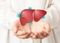 Hepatitis Dijuluki Silent Disease, Ini Gejala, Penyebab, dan Cara Mencegahnya